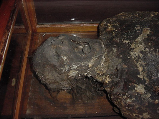 Illustration for article titled Drunk Museum Review: The Mütter Museum Will Give Me Nightmares Forever